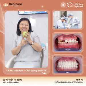 Khách hàng Trồng răng Implant tại DentCare
