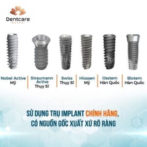 Các dòng trụ Implant chính hãng tại DentCare Dental bao gồm Straumann Thụy Sĩ, Nobel Biocare Mỹ, Osstem Hàn Quốc và Dentium